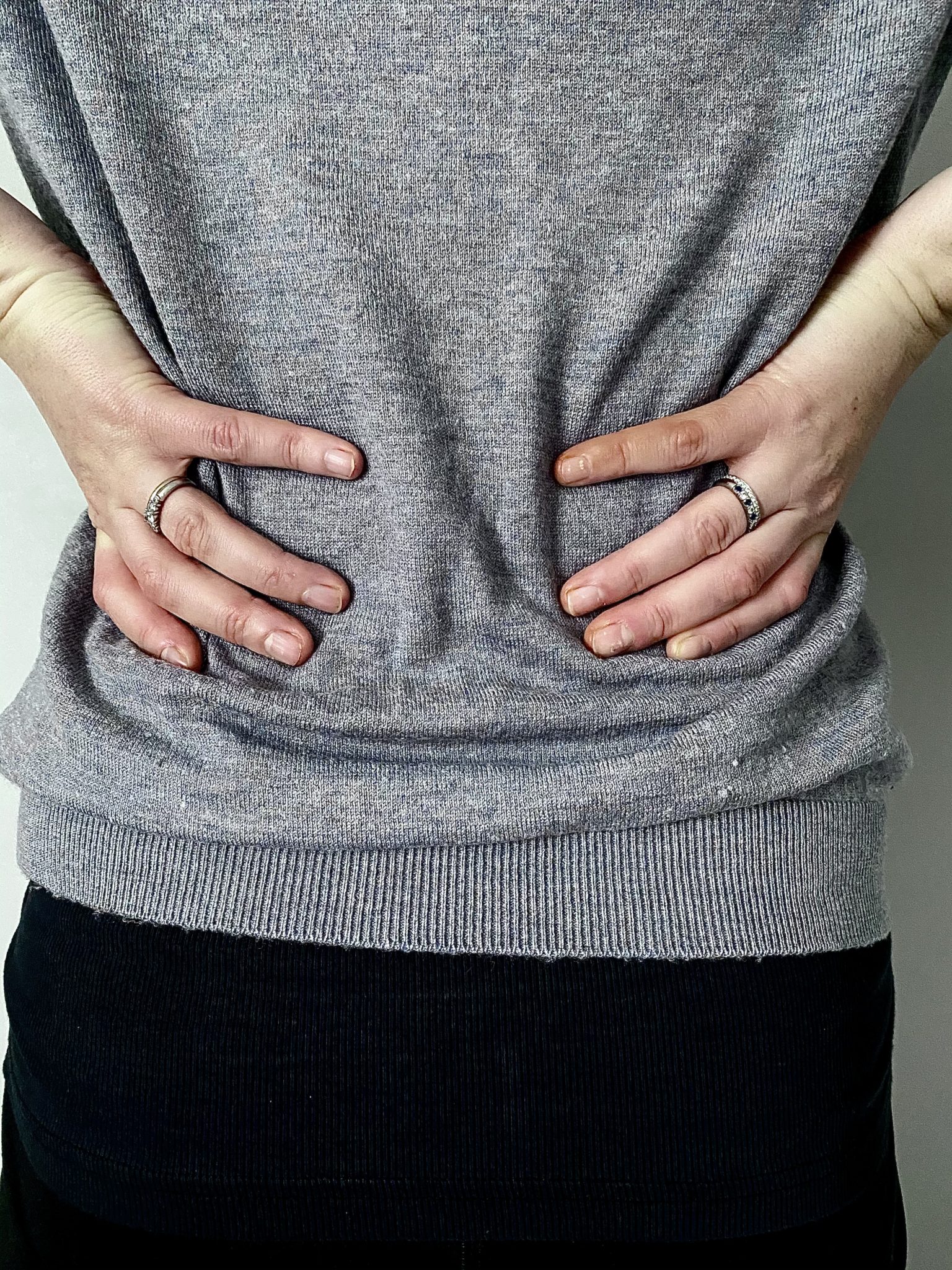 Non-specific mechanical low back pain - Cambridge Physiotherapy advice and exercises
